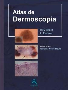 Atlas de Dermoscopia