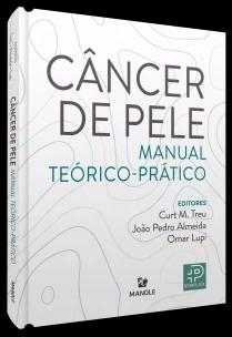 Câncer de pele