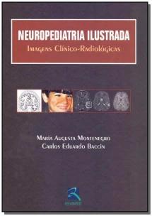 Neuropediatria Ilustrada