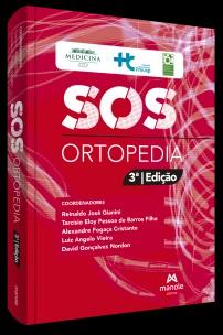 SOS Ortopedia