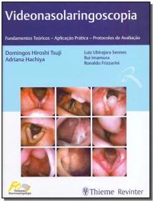 Videonasolaringoscopia